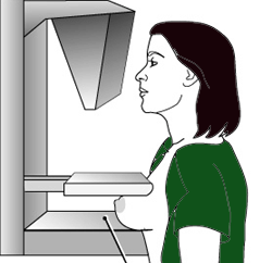 mamogram.gif