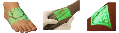 veinviewer.jpg