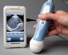 Ultrasom para smartphone